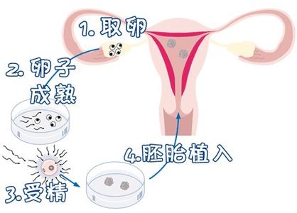 私人同性代怀助孕怎么收费生殖中心